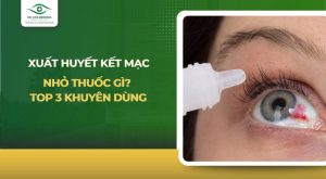 xuất huyết kết mạc nhỏ thuốc gì