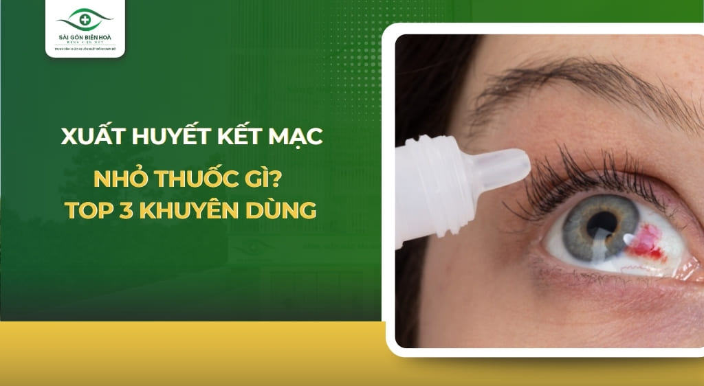 xuất huyết kết mạc nhỏ thuốc gì