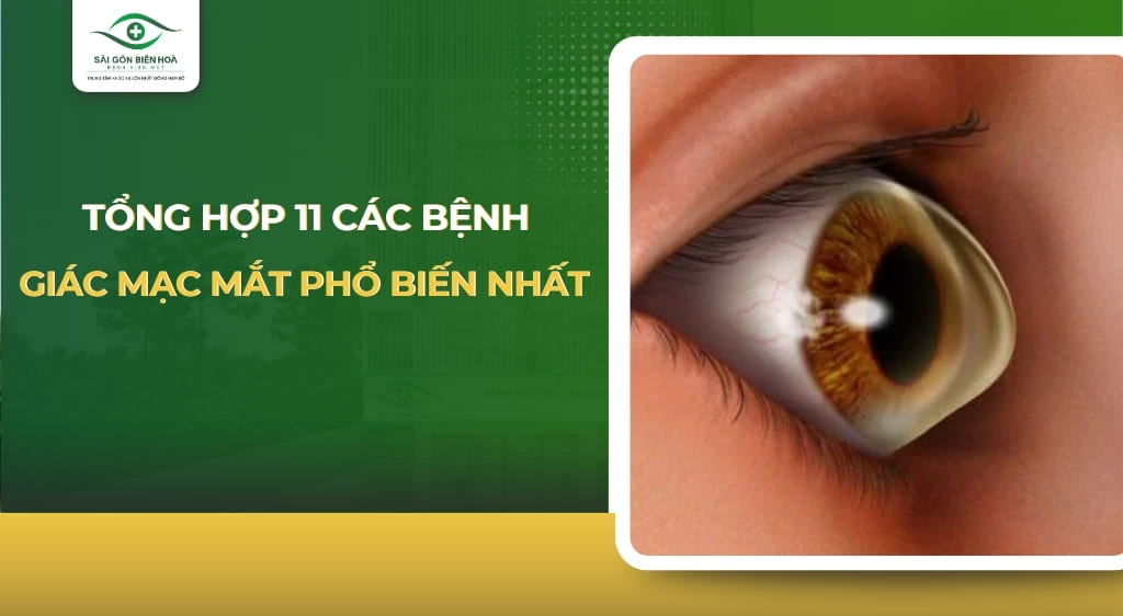 bệnh giác mạc mắt