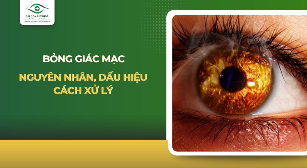bỏng giác mạc