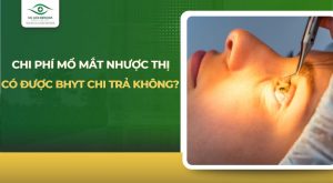 chi phí mổ mắt nhược thị