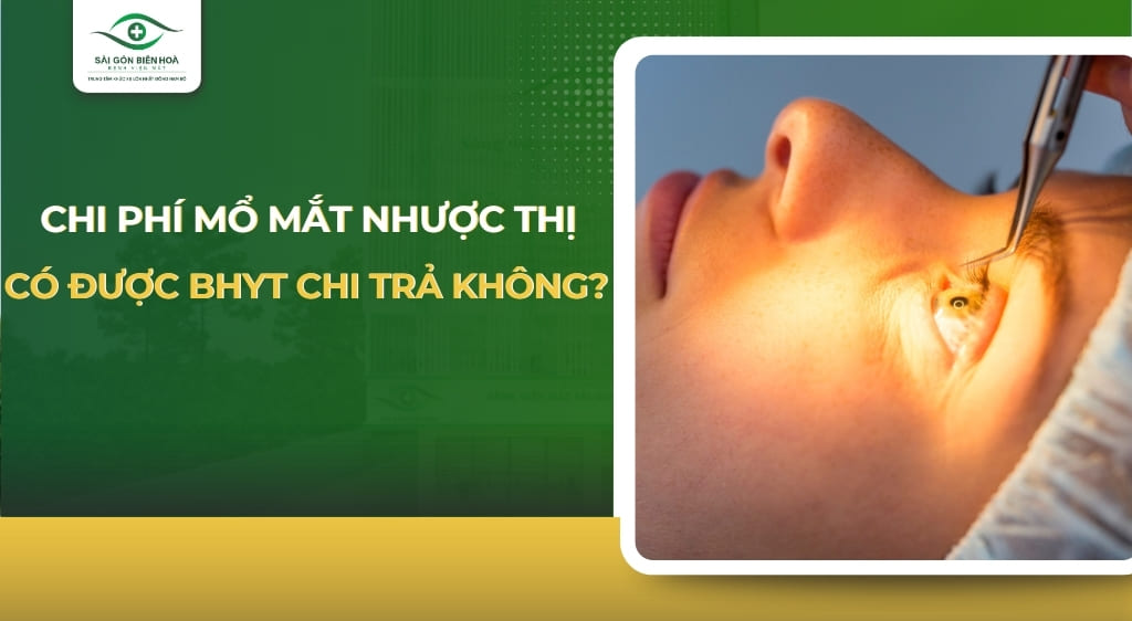 chi phí mổ mắt nhược thị