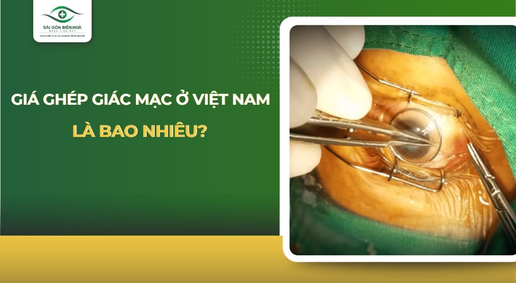 Phẫu thuật ghép giác mạc