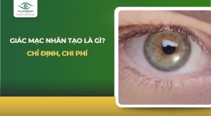giác mạc nhân tạo