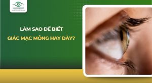 làm sao biết giác mạc mỏng hay dày