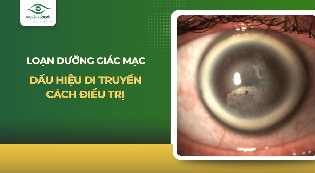 loạn dưỡng giác mạc