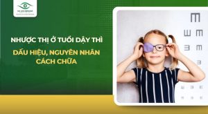 nhược thị ở tuổi dậy thì