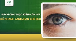 rách giác mạc kiêng ăn gì