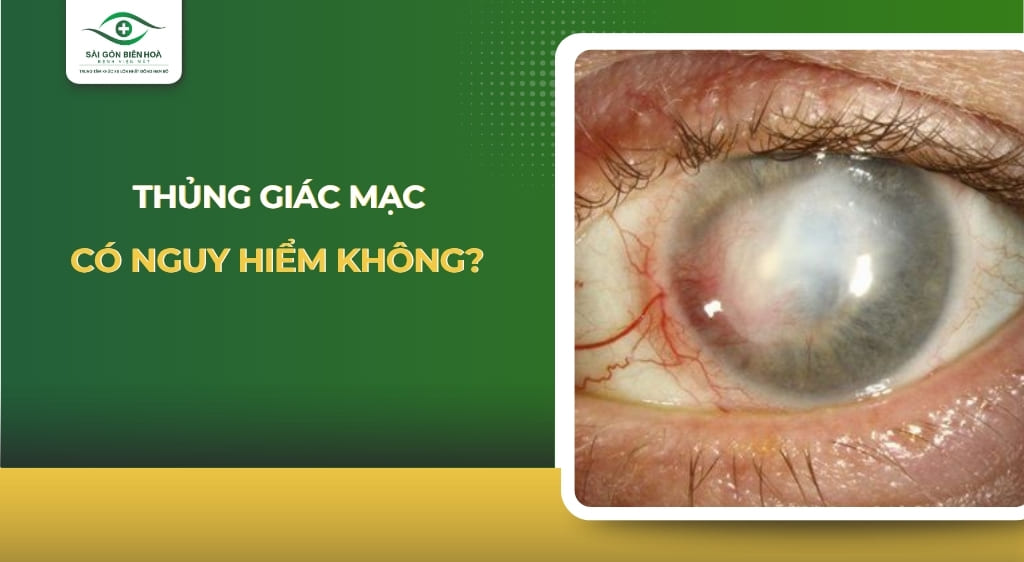 thủng giác mạc có nguy hiểm không