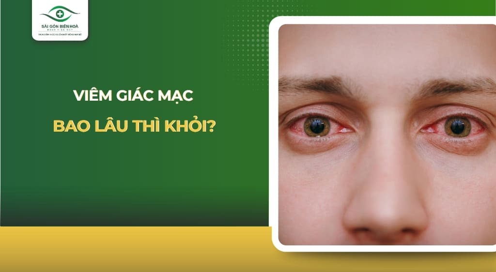bệnh viêm giác mạc bao lâu khỏi