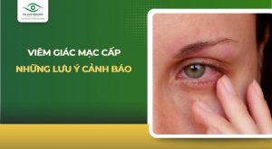 viêm giác mạc cấp
