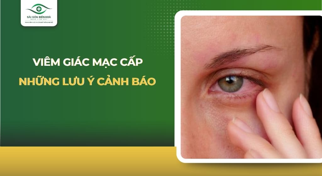 viêm giác mạc cấp