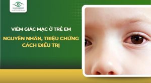 viêm giác mạc ở trẻ em