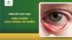 viêm kết giác mạc