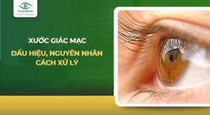 xước giác mạc