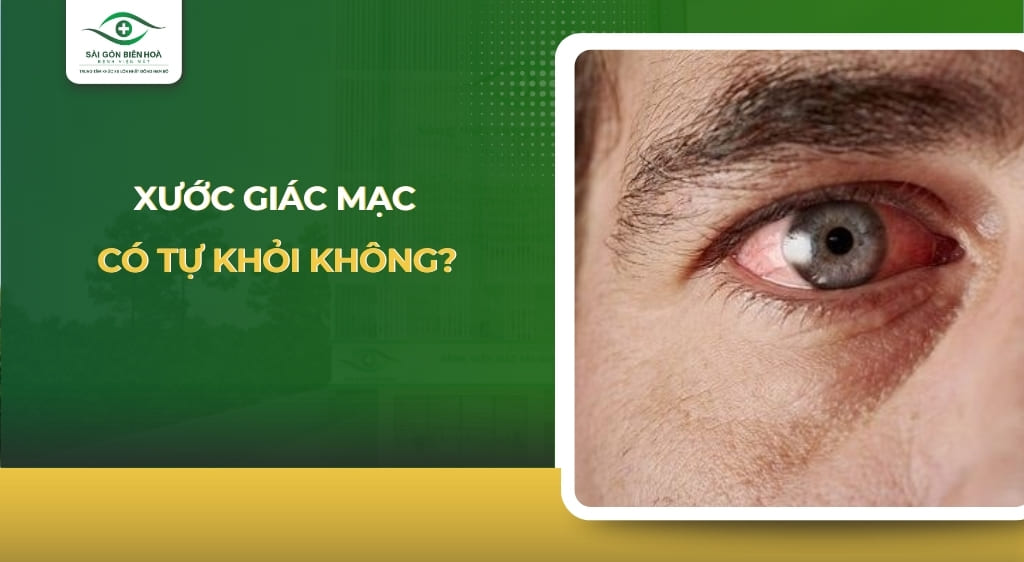 xước giác mạc có tự khỏi không