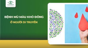 bệnh mù màu máu khó đông ở người di truyền