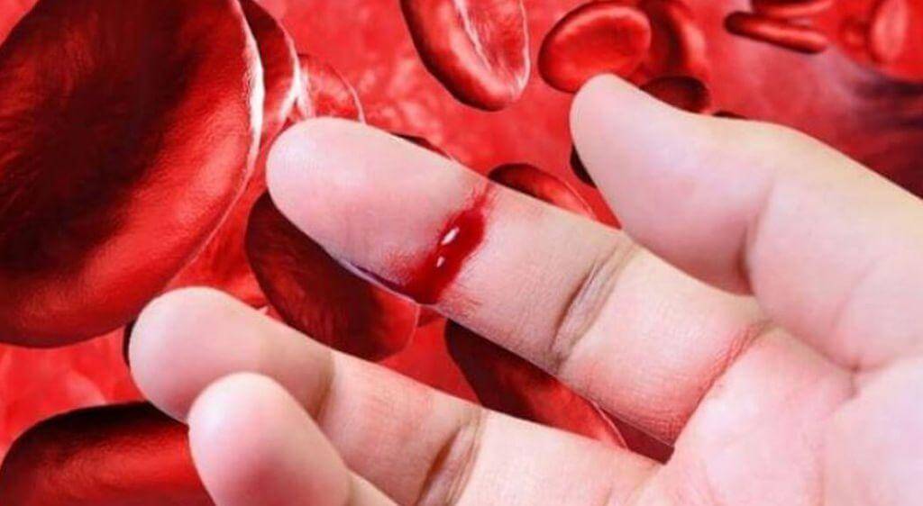 Bệnh mù màu máu khó đông di truyền chéo từ mẹ sang con trai
