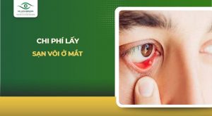 chi phí lấy sạn vôi ở mắt