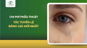 chi phí phẫu thuật tắc tuyến lệ