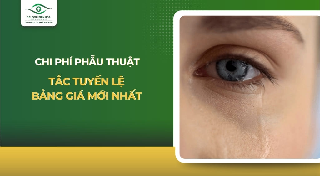 chi phí phẫu thuật tắc tuyến lệ