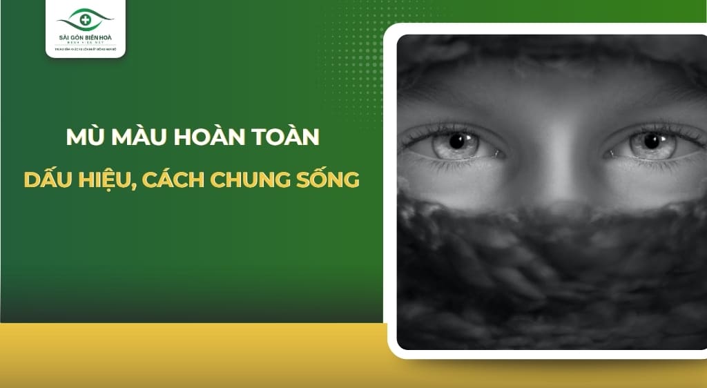 mù màu hoàn toàn