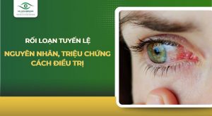 rối loạn tuyến lệ