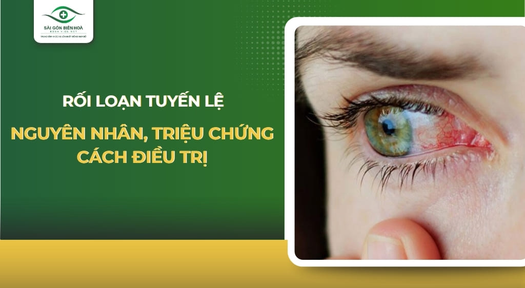 rối loạn tuyến lệ