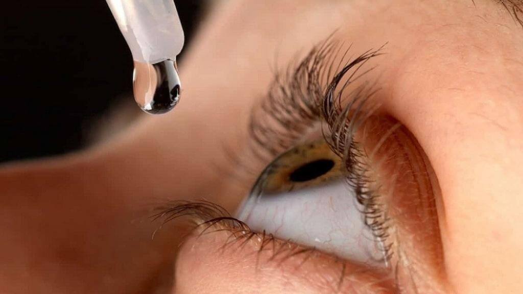 Sử dụng thuốc nhỏ mắt dị ứng giảm nhanh triệu chứng ngứa và đỏ mắt