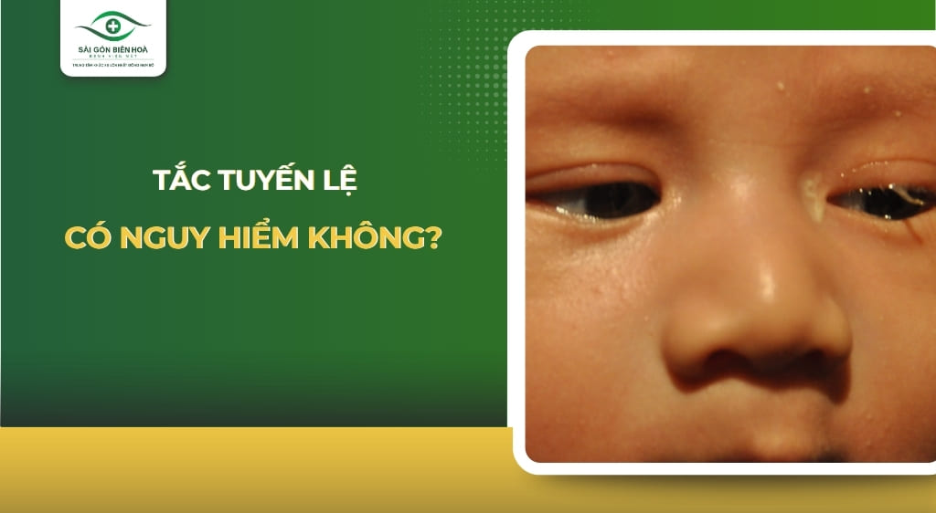 tắc tuyến lệ có nguy hiểm không
