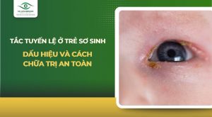 tắc tuyến lệ ở trẻ sơ sinh