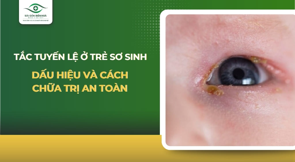 tắc tuyến lệ ở trẻ sơ sinh
