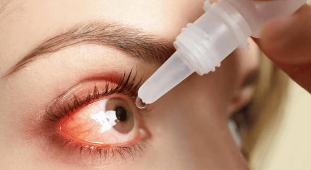 Về mặt điều trị, thuốc nhỏ mắt trị cườm khô không thể thay thế phẫu thuật