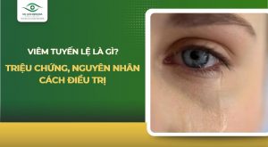 viêm tuyến lệ