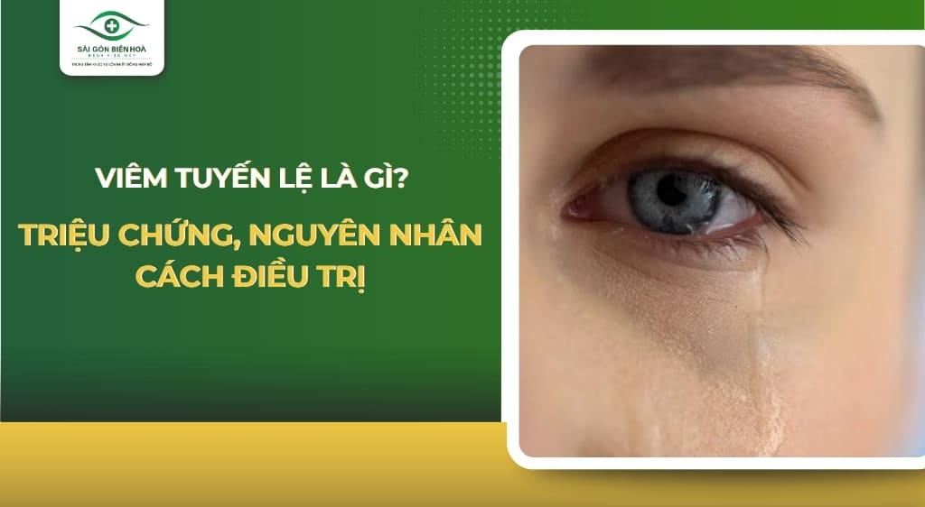 viêm tuyến lệ