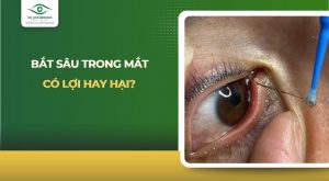 bắt sâu trong mắt
