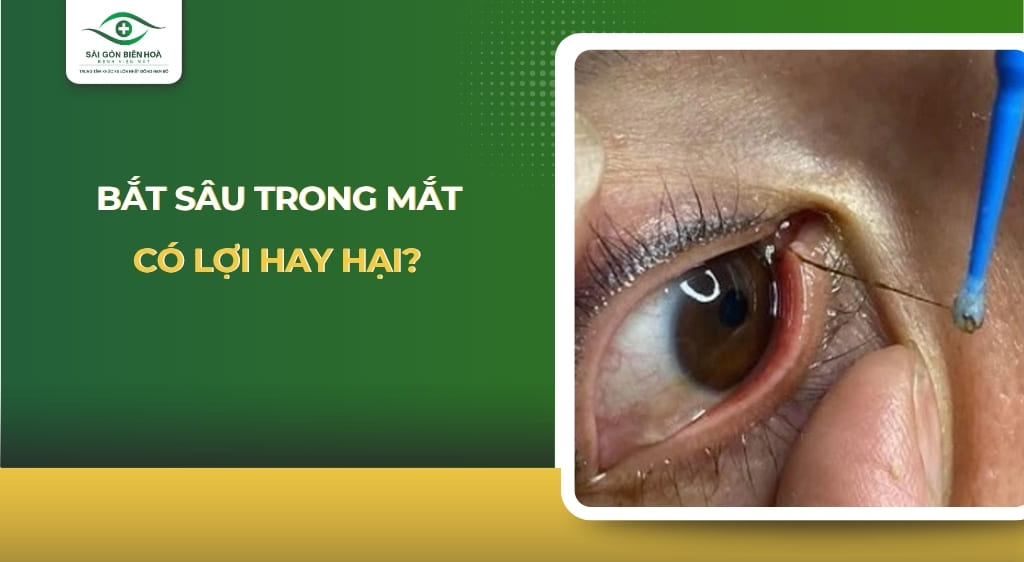 bắt sâu trong mắt