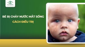 Bé bị chảy nước mắt sống