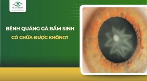 bệnh quáng gà bẩm sinh