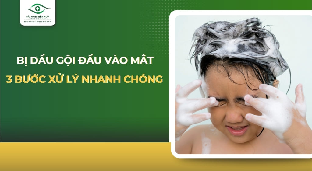 Bị dầu gội đầu vào mắt