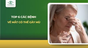 các bệnh về mắt có thể gây mù
