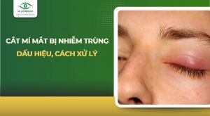 Cắt mí mắt bị nhiễm trùng
