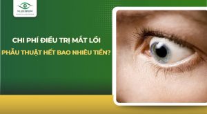 chi phí điều trị mắt lồi