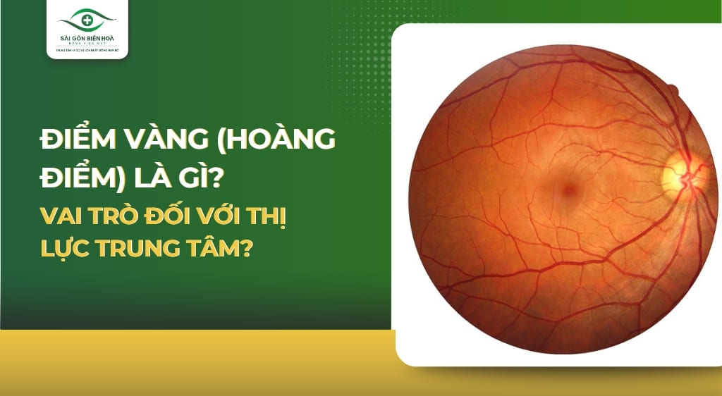 Điểm vàng