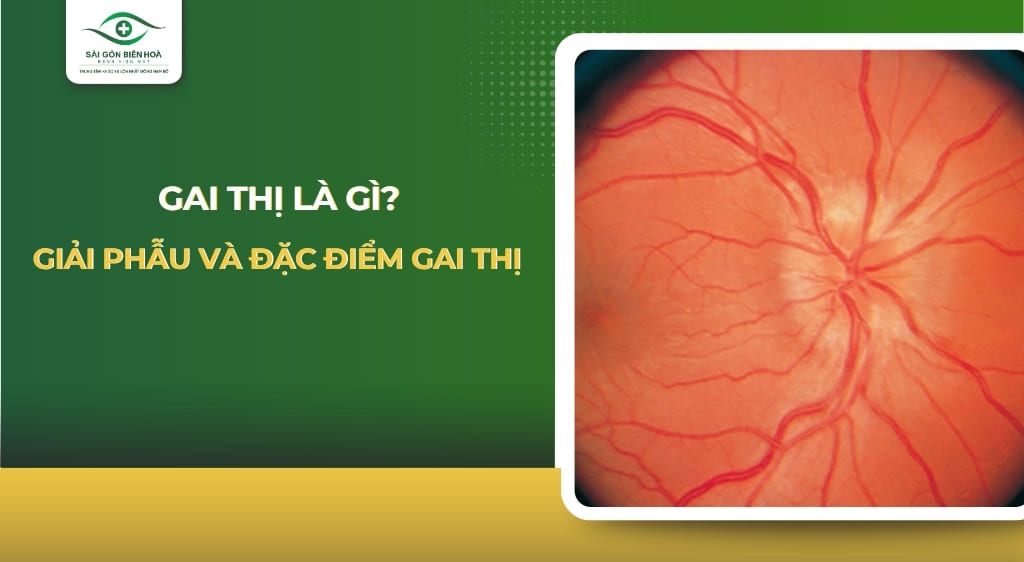 gai thị