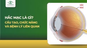 Hắc mạc