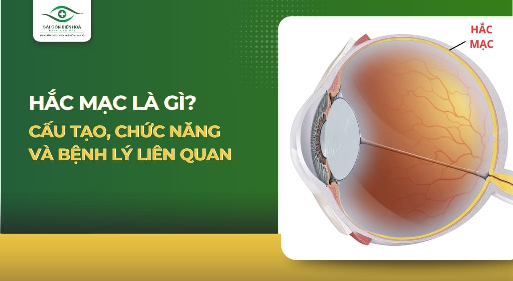 Hắc mạc