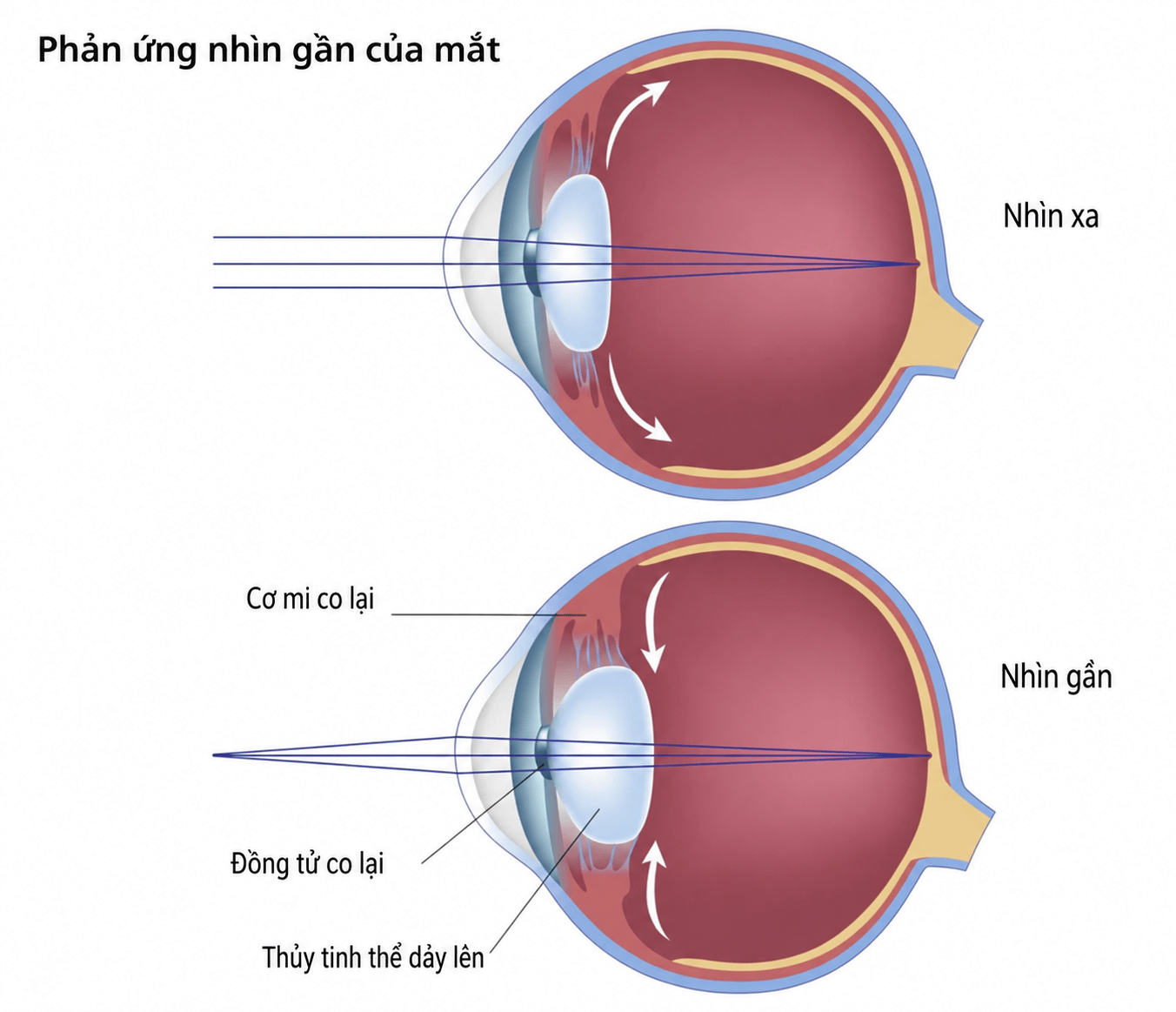 Khi nhìn gần, cơ mi co lại giúp thuỷ tinh thể phồng lên để tăng khả năng hội tụ ánh sáng