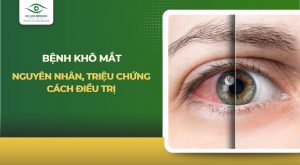 Khô mắt