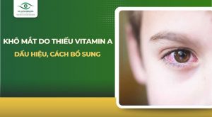 khô mắt do thiếu vitamin a